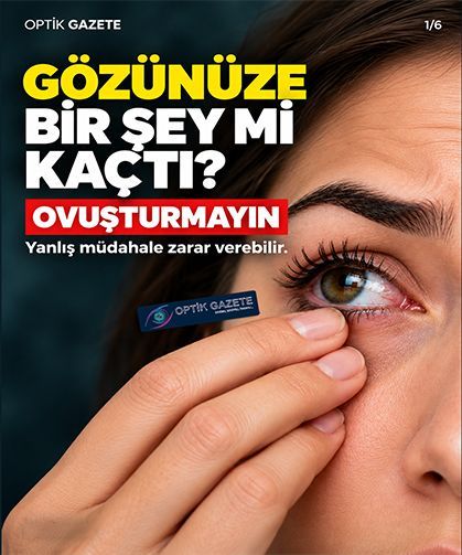Gözünüze Bir Şey Mi Kaçtı? Ovuşturmak Sorunu Büyütebilir