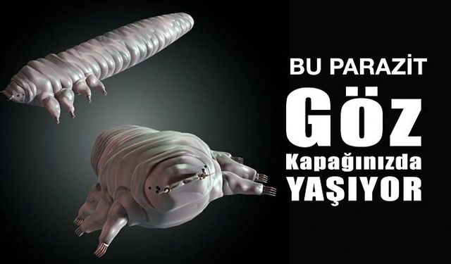 Göz Kapaklarınızda Yaşayan Parazit Demodeks