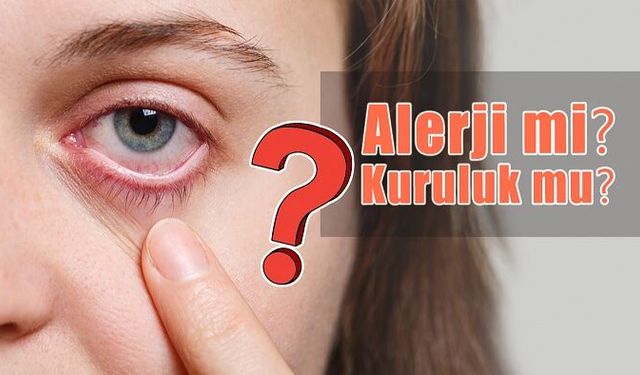 Göz Kuruluğu ile Göz Alerjisi Arasındaki Farkı Nasıl Anlarsınız?