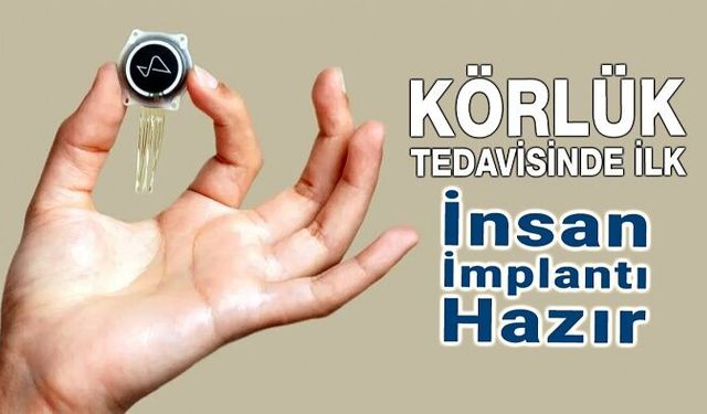 Körlük Tedavisinde İlk İnsan İmplantı Hazır
