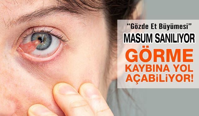 Göz Etine Yol Açan 4 Önemli Etken!