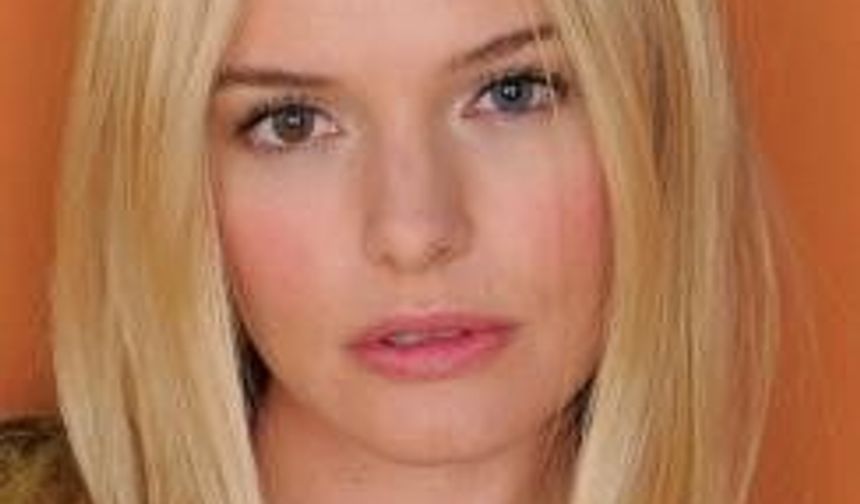 Kromozom Bozukluğu Olan Ünlüler!