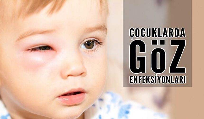 Çocuklarda Göz Enfeksiyonları