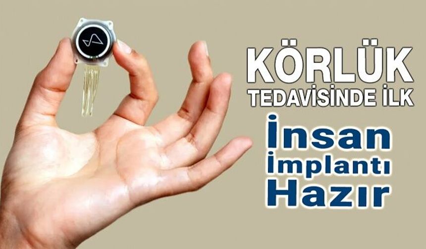 Körlük Tedavisinde İlk İnsan İmplantı Hazır