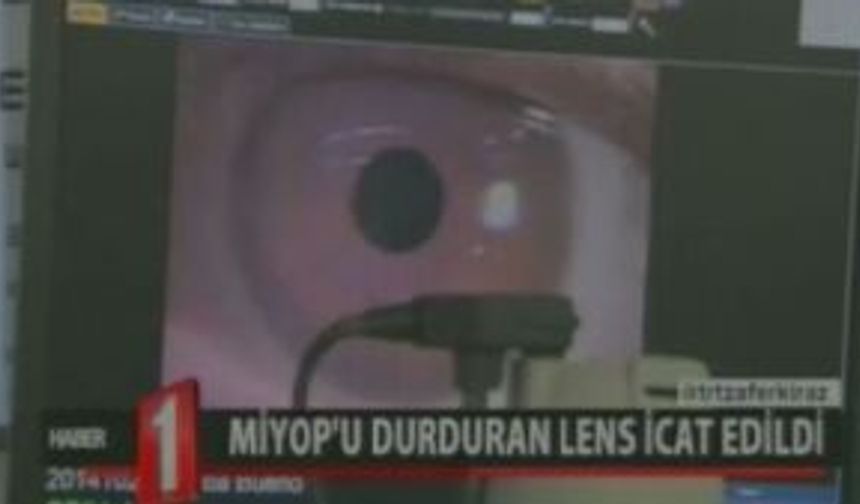 Bilim İnsanları Miyop Hastalığını Engelleyen Lens Üretmeyi Başardı