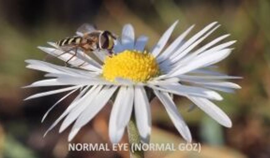 GÖZ BOZUKLUKLARI - Astigmatizm - Miyop - Hipermetrop