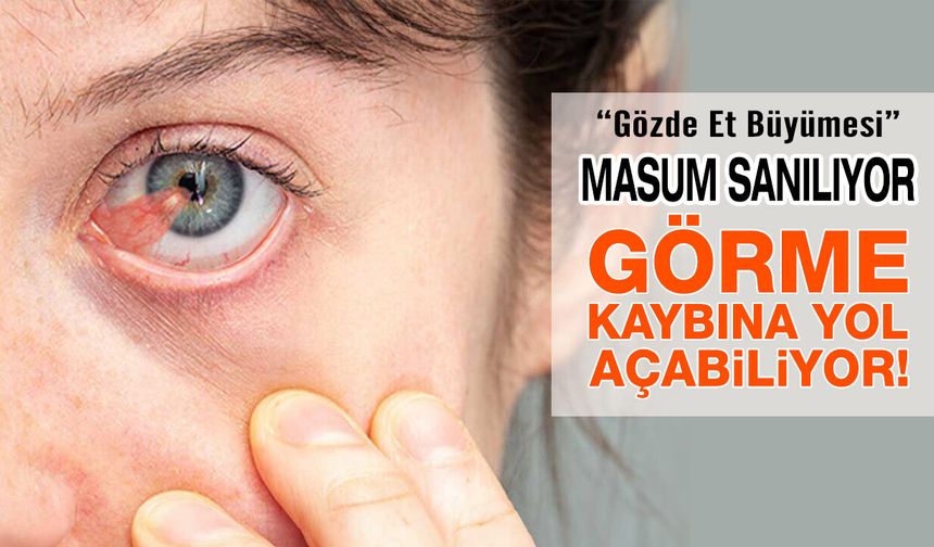 Göz Etine Yol Açan 4 Önemli Etken!